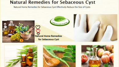 Natural-Treatment-for-Sebaceous-Cyst