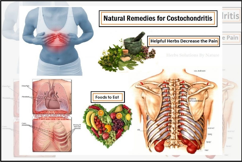 Costochondritis Treatment Natural Remedies Decrease the Pain Herbs