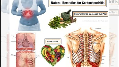 Costochondritis Treatment Natural Remedies Decrease the Pain