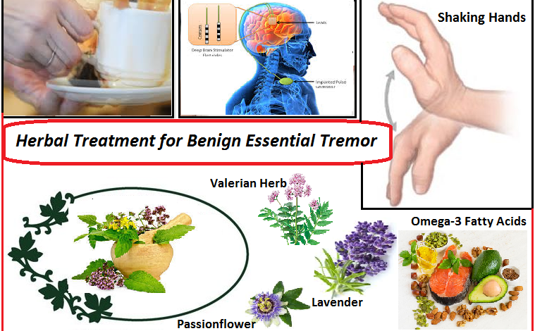 Natural Remedies for Benign Essential Tremor and Tips for Surviving