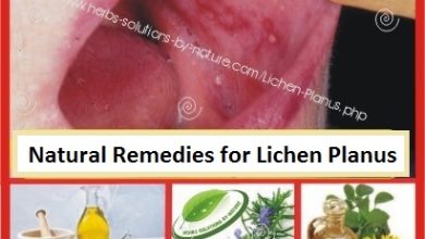 Herbal-Treatment-for-Lichen-Planus