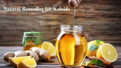 Natural-Remedies-for-Keloids-1