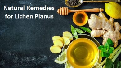 Natural-Remedies-for-Lichen-Planus