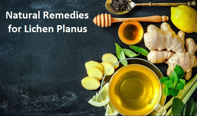 Natural-Remedies-for-Lichen-Planus