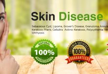 Effective Natural Home Remedies for Skin Problems