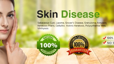 Top 13 General Skin Diseases and Conditions