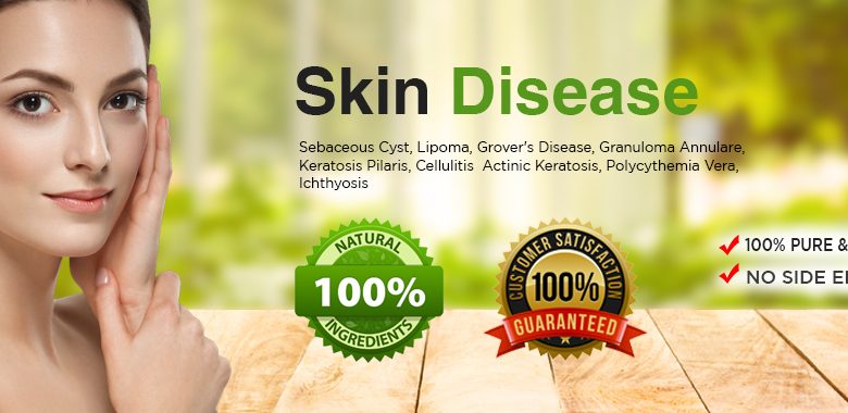 Top 13 General Skin Diseases and Conditions