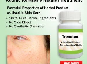 Natural Remedies for Actinic Keratosis Help to Relief for Skin Infection