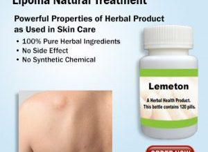 Amazing Natural Home Remedies to Reduces Lipoma