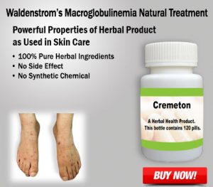 Waldenstrom's Macroglobulinemia