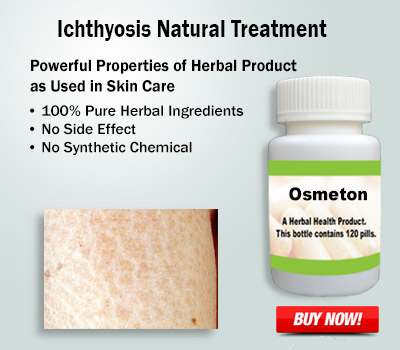 Herbal Supplement for Ichthyosis