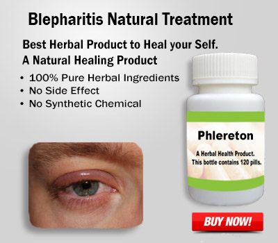 Herbal Supplement for Blepharitis