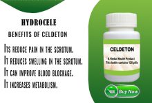 Herbal Remedies for Hydrocele