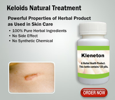 Herbal Supplement for Keloids