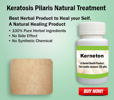 Herbal Supplement for Keratosis Pilaris