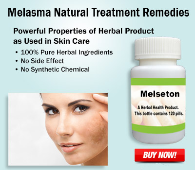 Herbal Supplement for Melasma