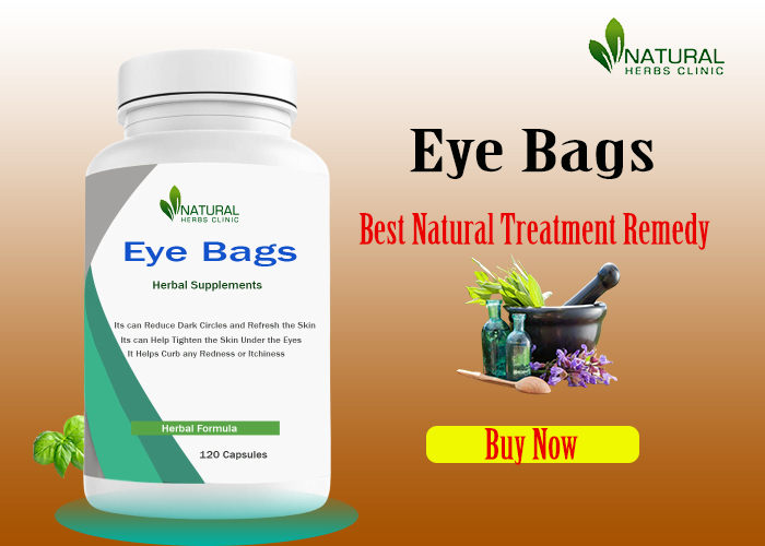 Eye Bags Home Remedies