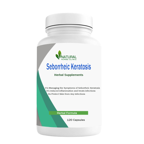 natural remedies for seborrheic keratosis
