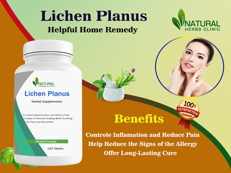 natural remedies for lichen planus