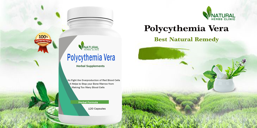 Polycythemia Vera Natural Treatments