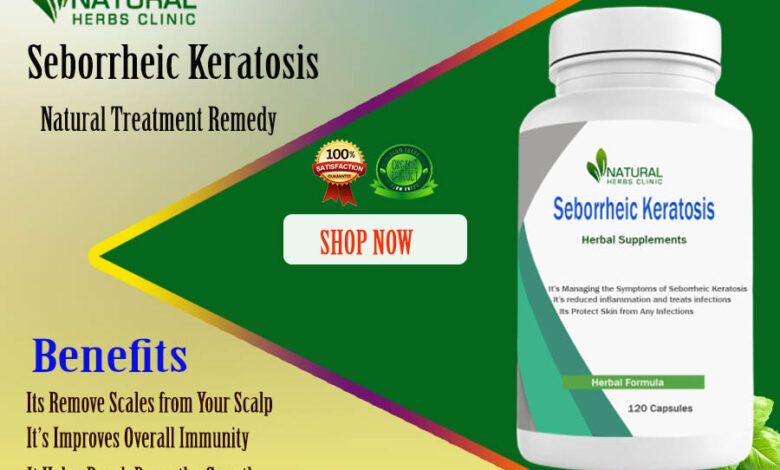 Seborrheic Keratosis Home Remedies