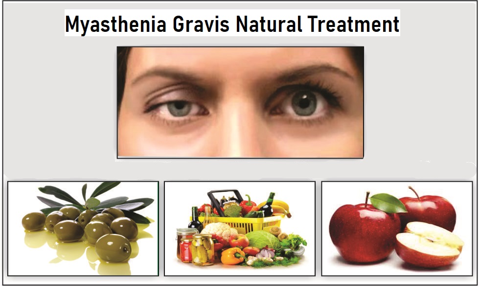 myasthenia gravis natural treatment