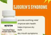 Natural Remedies for Sjogren's Syndrome