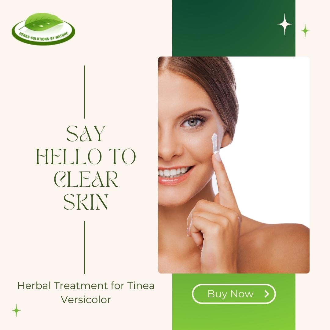 Herbal Treatment for Tinea Versicolor