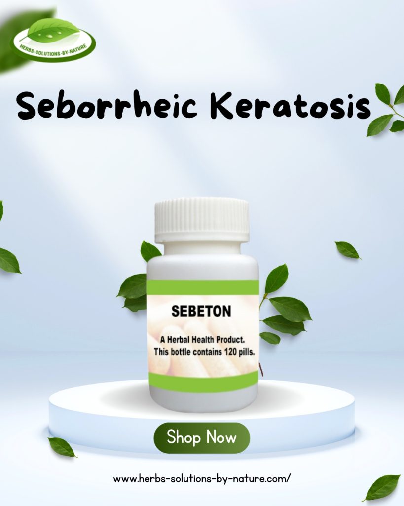 Seborrheic Keratosis Home Remedy