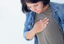 How to Manage Costochondritis