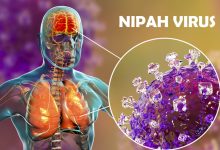 Nipah Virus Symptoms in Humans