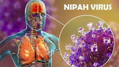 Nipah Virus Symptoms in Humans
