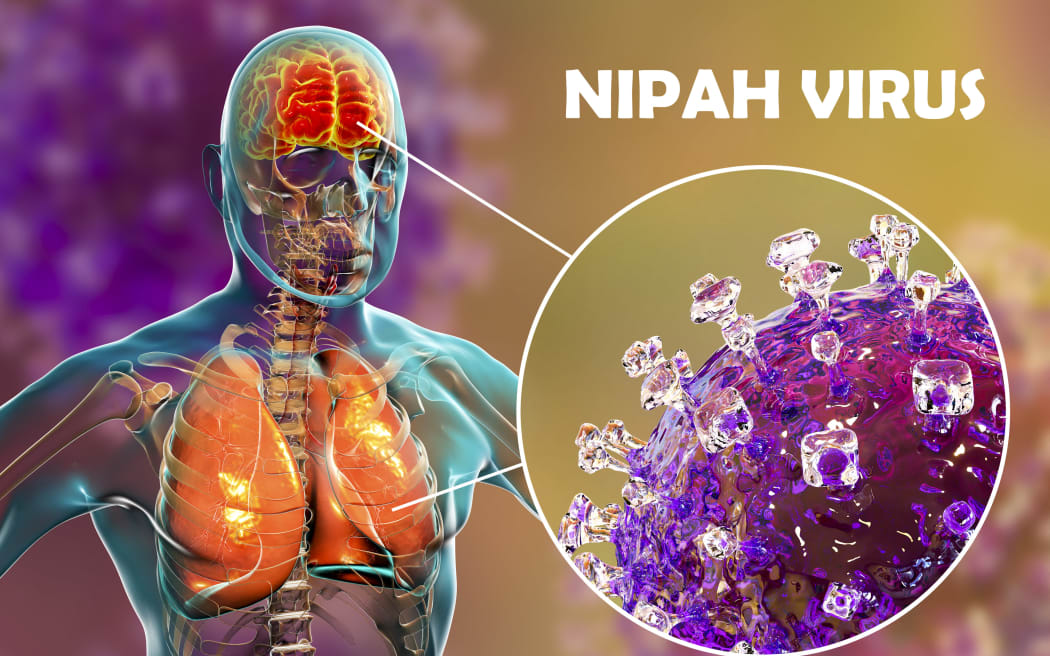 Nipah Virus Symptoms in Humans Don't Ignore These Warning Signs