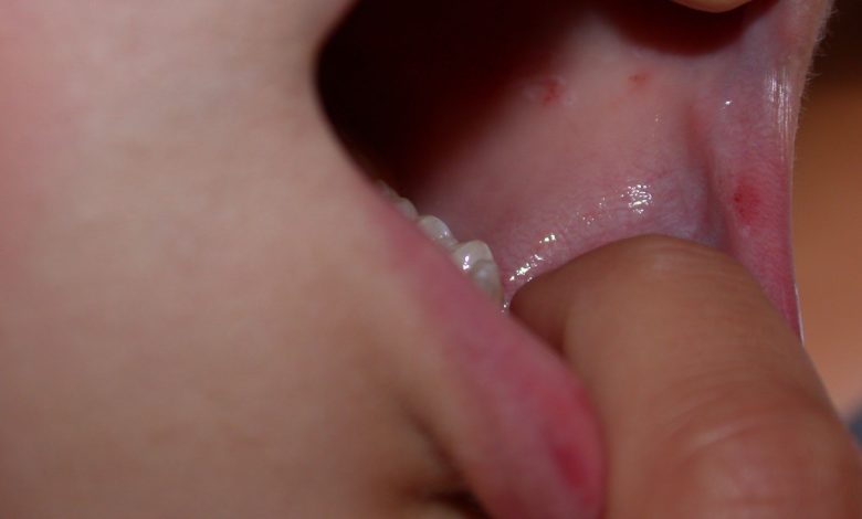 Rashes on The Skin or Inside of The Mouth