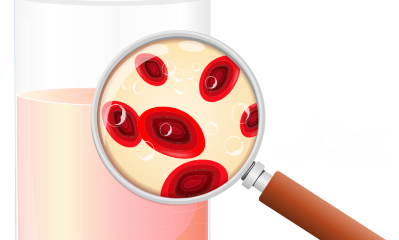 Blood in The Urine