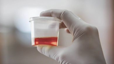 Blood in the Urine
