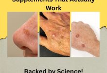 Actinic Keratosis Supplements That Actually Work