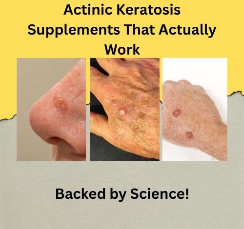 Actinic Keratosis Supplements That Actually Work
