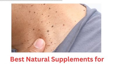 Best Natural Supplements for Seborrheic Keratosis