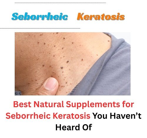 Best Natural Supplements for Seborrheic Keratosis