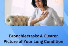 Bronchiectasis