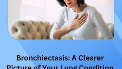 Bronchiectasis