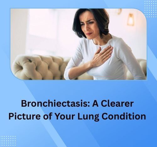 Bronchiectasis