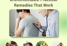 Best Natural Treatment for Bronchiectasis