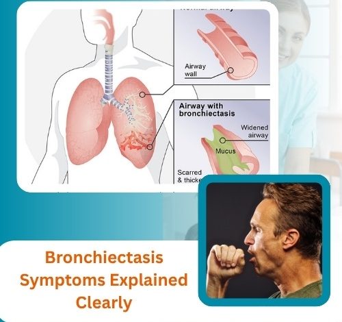 Bronchiectasis Symptoms Explained Clearly