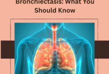 Promising New Treatments for Bronchiectasis