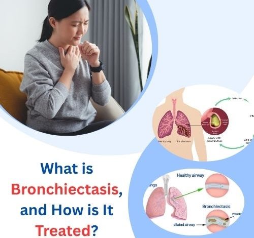 What is Bronchiectasis