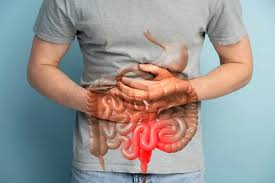 Natural Rectal Prolapse Treatment at Home 1