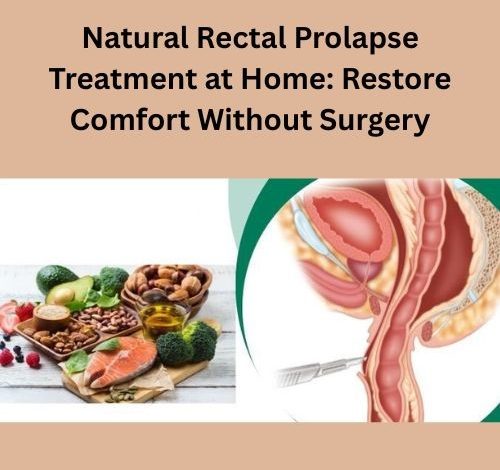 Natural Rectal Prolapse Treatment at Home