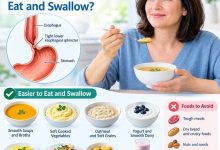Achalasia diet showing soft foods that are easier to eat and swallow